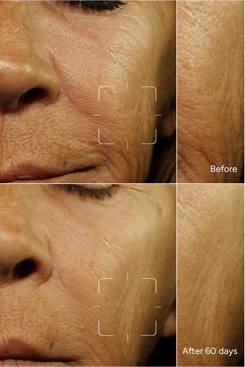 Formula 9 - Retinol 0.4%