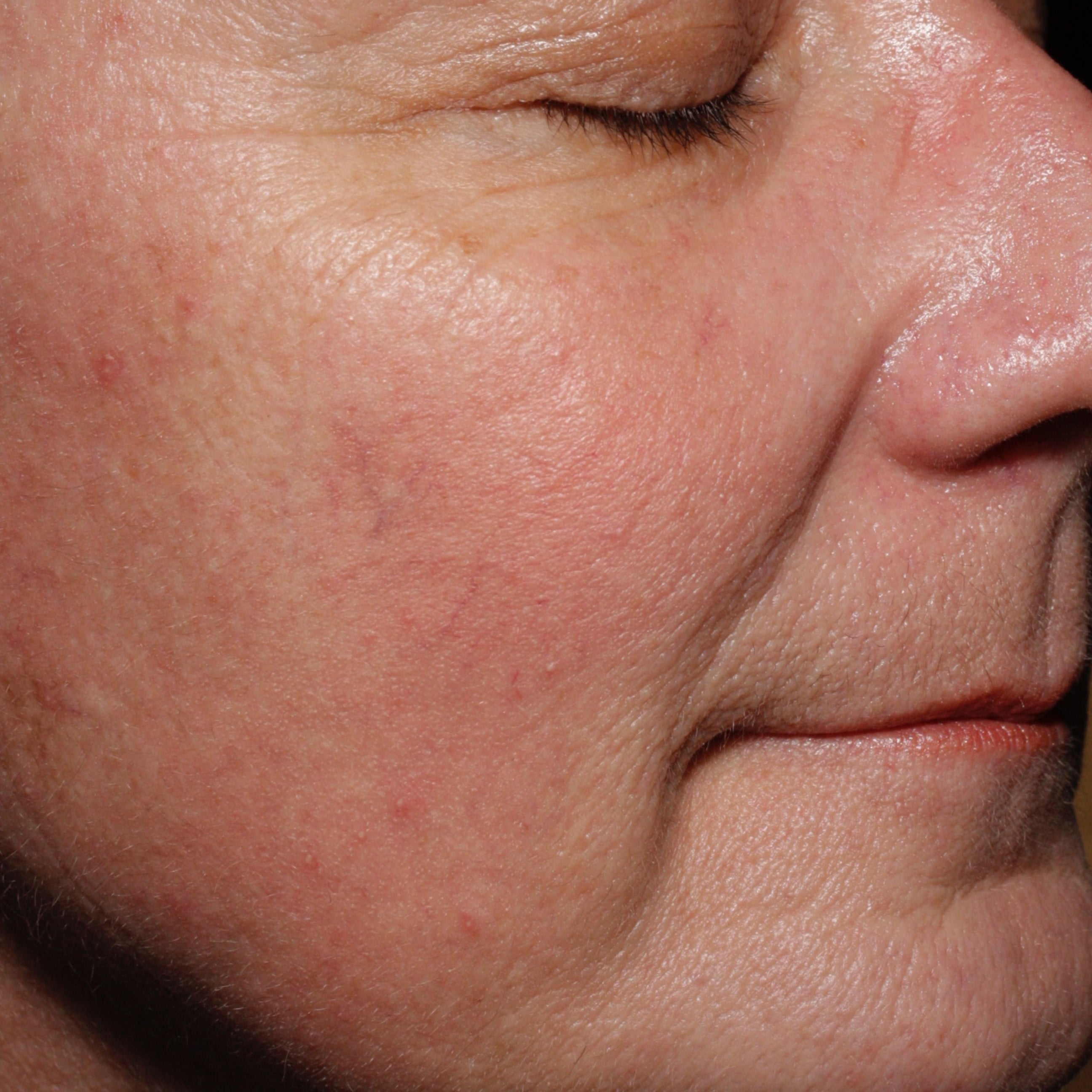 Close-up of a person's face with visible skin texture and pores.