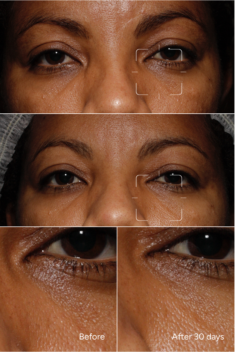 Formula 52 - Dark Circles for Melanin Rich Skin