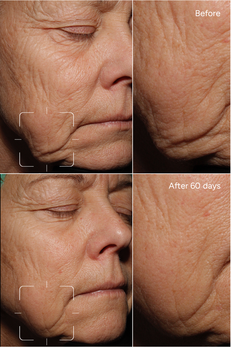 Formula 15 - SAG NO MORE - Anti gravity Face serum to adress skin laxity