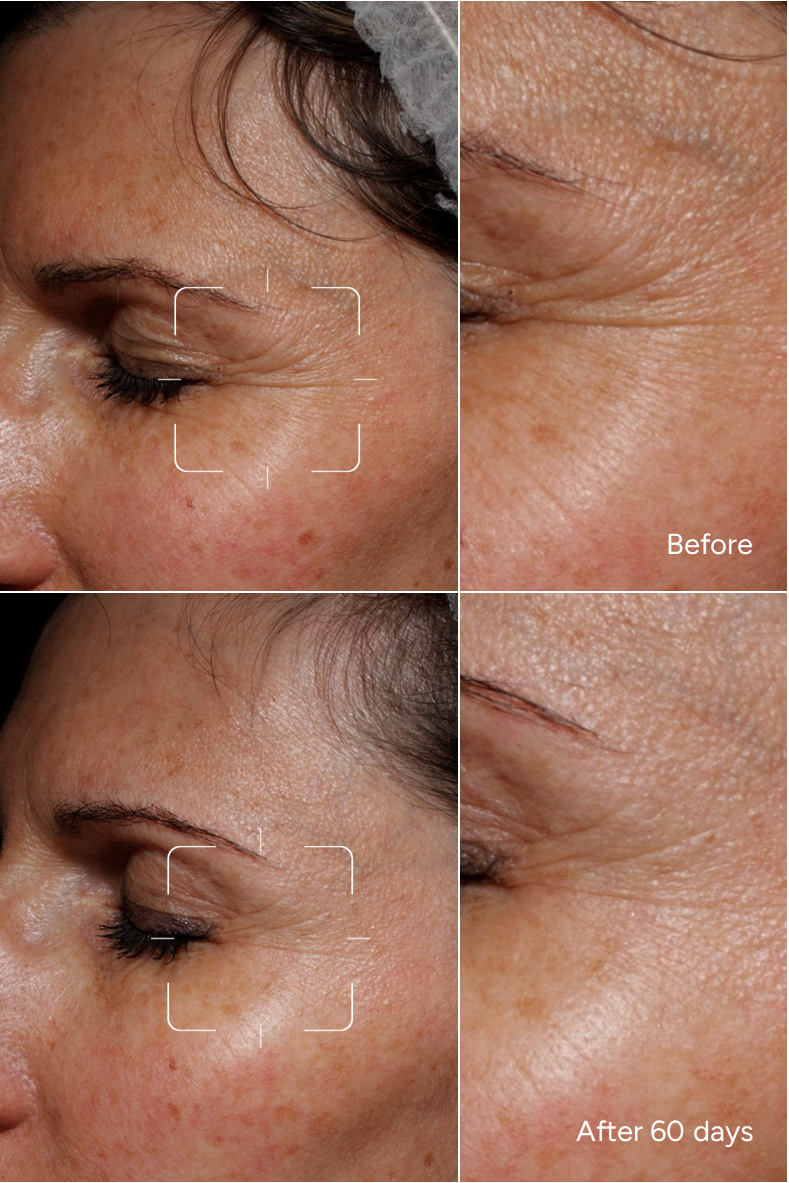 Formula 48 - SUPER SKIN BOOSTER - Fine Lines & Wrinkles