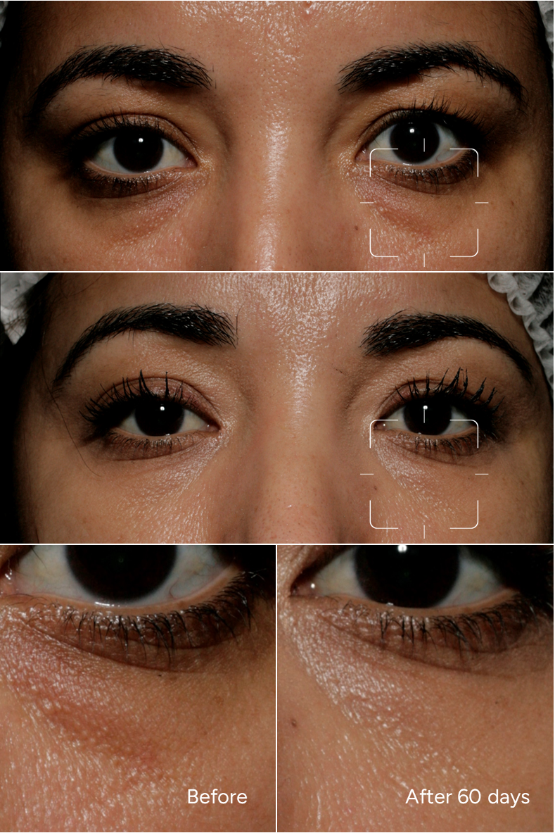 Formula 50 - Hollowed Eyes