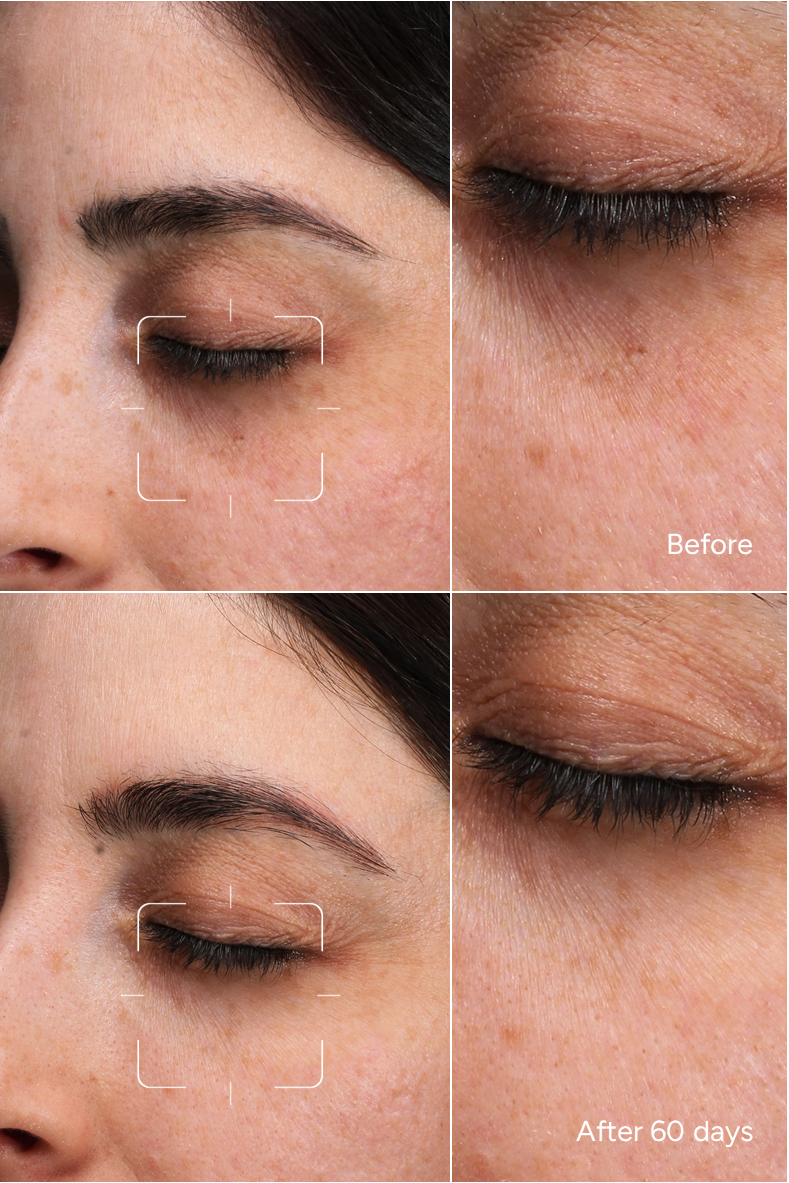 Formula 53 - Dark Circles for Light Skin