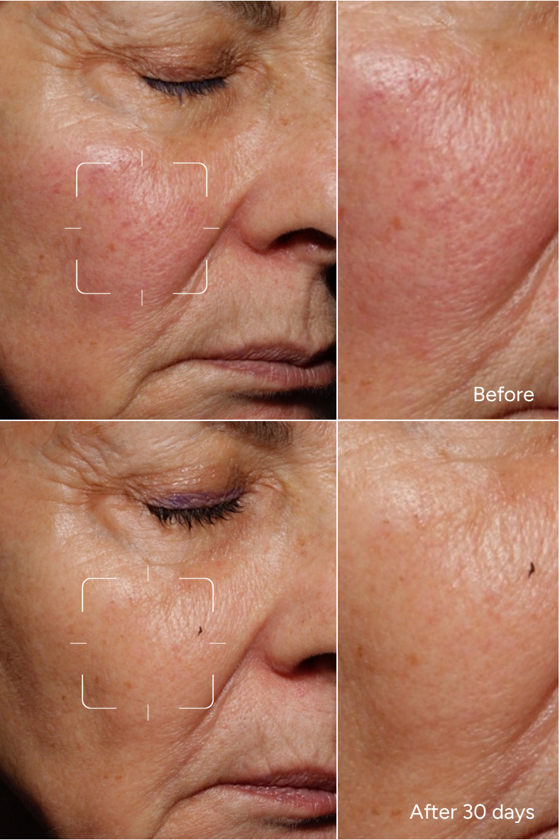 Formula 17 – Niacinamide 8 %