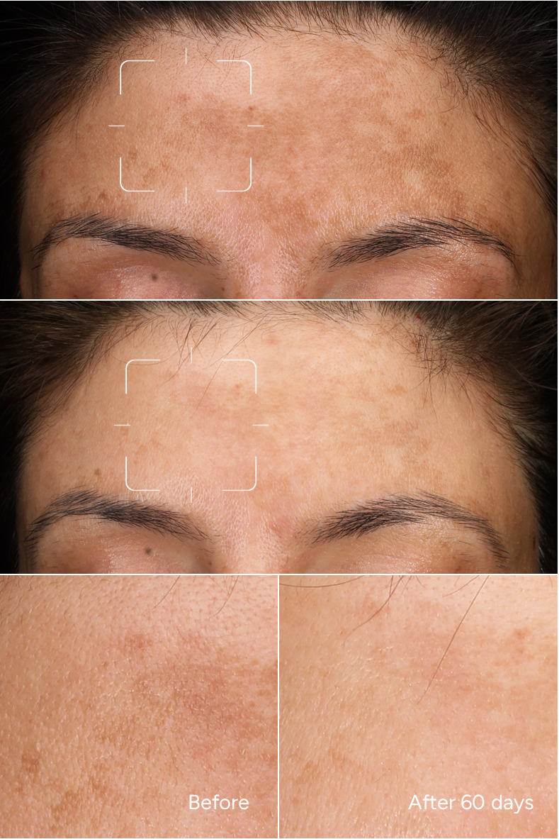 Formula 41 - Alpha Arbutin 3%