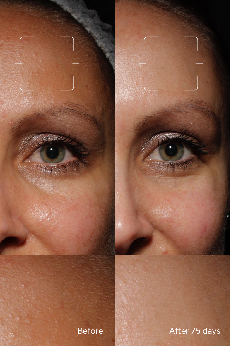 Fórmula 42 – Corrector de Pigmento para Piel Sensible