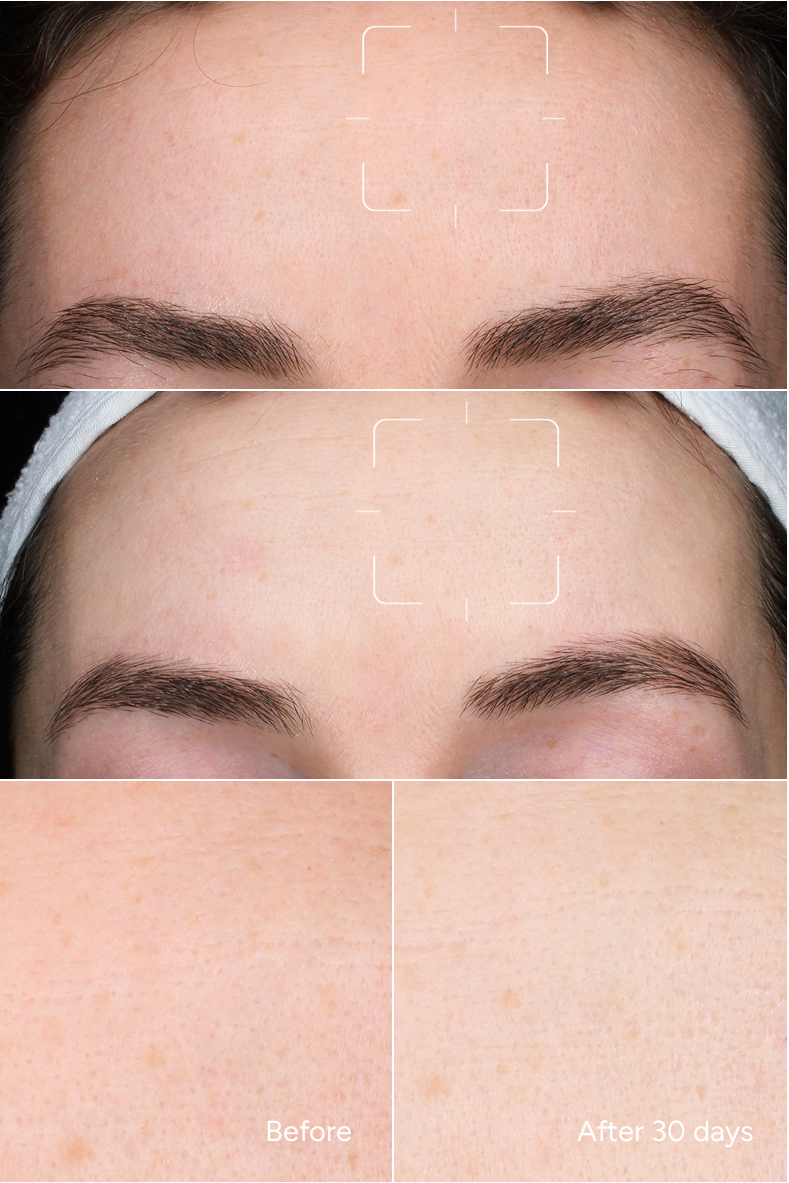 Formula 8 - Retinol 0.2%