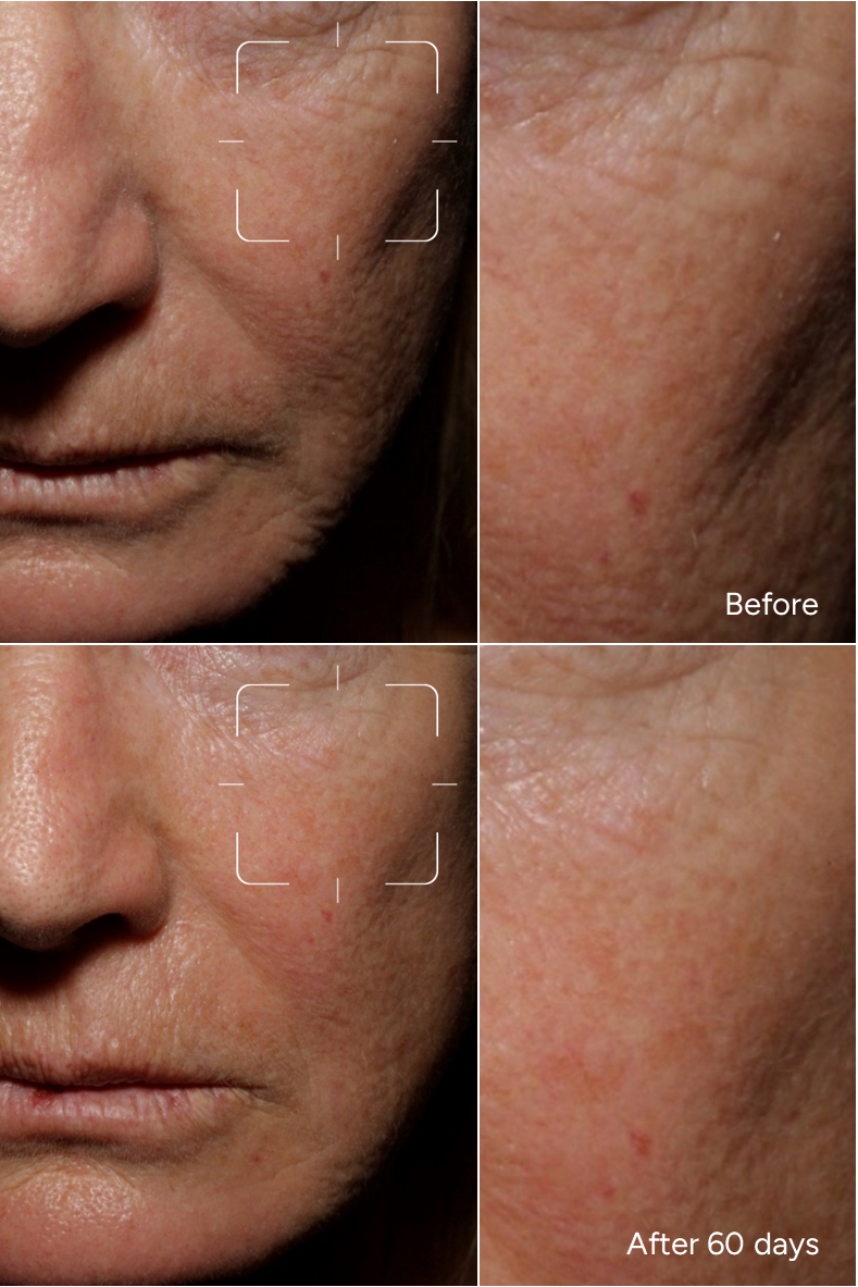 Fórmula 12 - SUPER SKIN BOOSTER para pieles secas y sensibles - Suero facial para una tez radiante