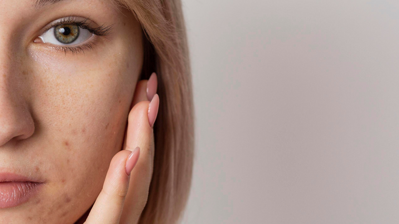 Face Texture Problems Skin texture cheat sheet – Universkin