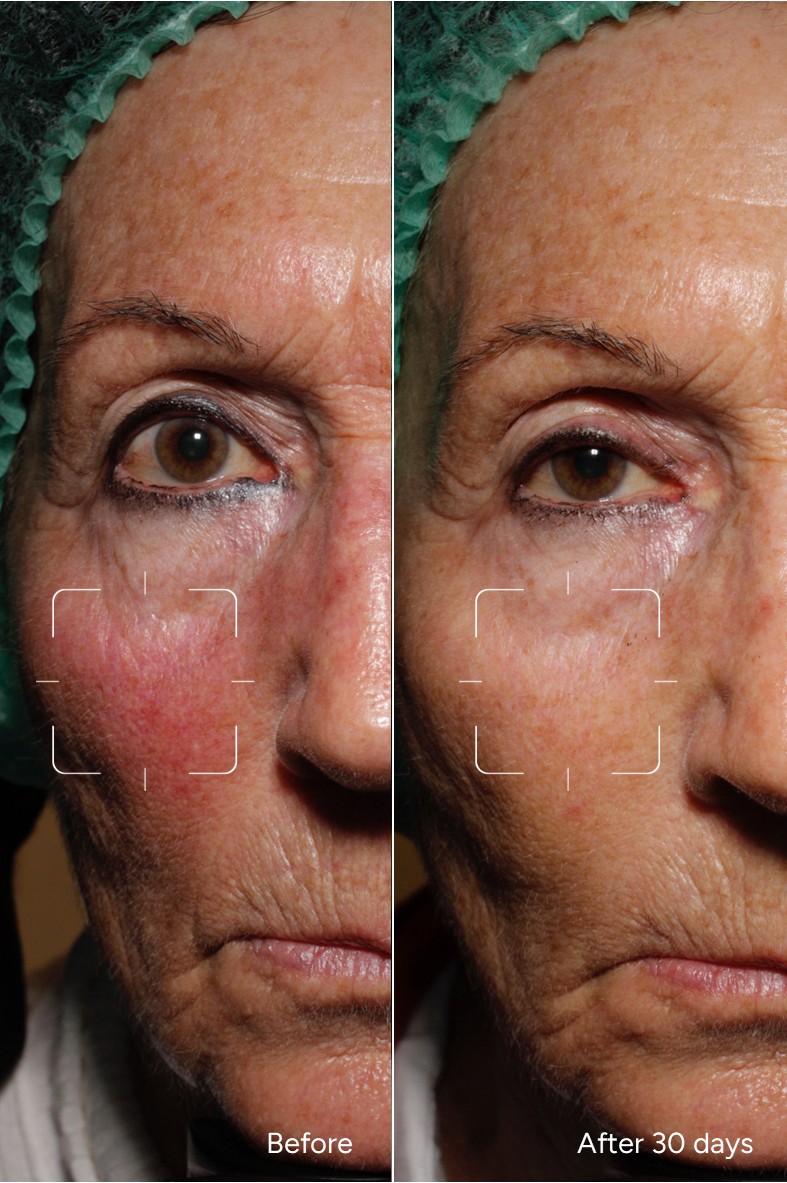 Fórmula 12 - SUPER SKIN BOOSTER para pieles secas y sensibles - Suero facial para una tez radiante