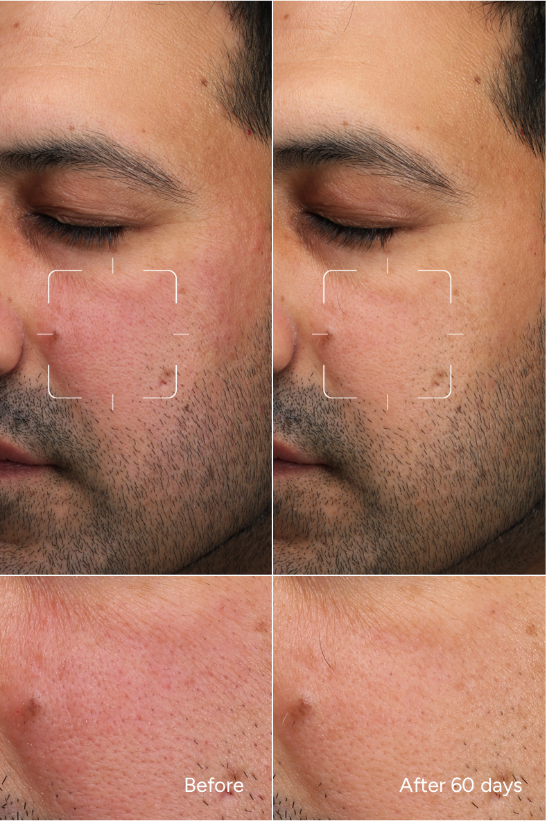 Formula 31 - PEEL 2glow - Siero viso