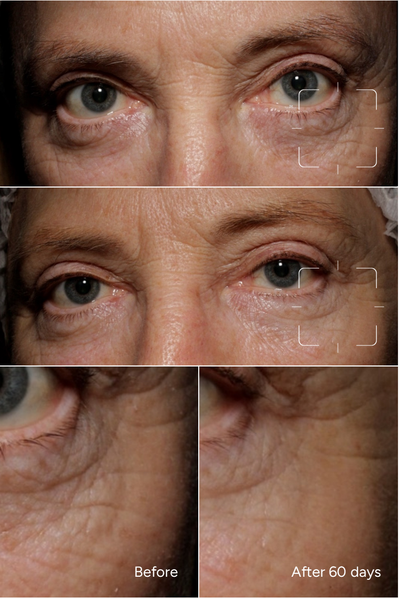 Formula 49 - SUPER SKIN BOOSTER - For a refreshed, lifted and smooth eye contour