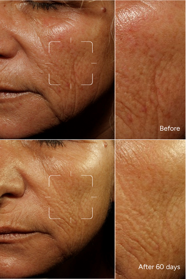 Formula 7 - ONE LIFE IN THE SUN - Face serum to address chronique sun exposure
