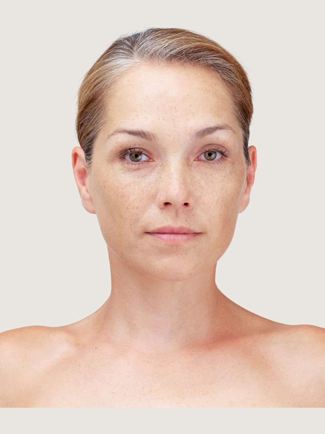Retrato de una mujer de unos cuarenta años con la piel llena de pecas